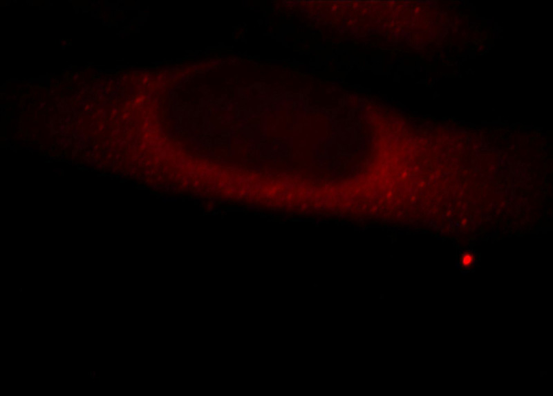 Immunofluorescent analysis of HepG2 cells, using MICAL2 antibody Catalog No:112610 at 1:25 dilution and Rhodamine-labeled goat anti-rabbit IgG (red).