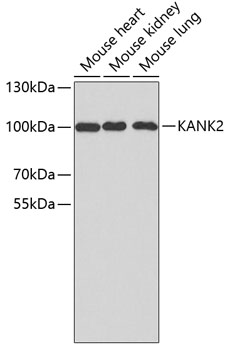 Western blot - KANK2 Polyclonal Antibody 
