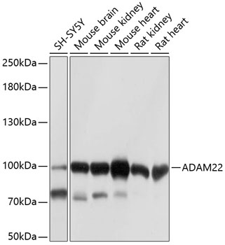 Western blot - ADAM22 Polyclonal Antibody 