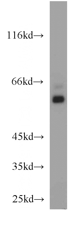 human brain tissue were subjected to SDS PAGE followed by western blot with Catalog No:115808(STXBP1 antibody) at dilution of 1:800