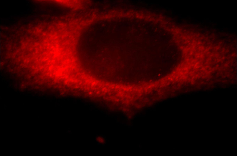 Immunofluorescent analysis of Hela cells, using KANK2 antibody Catalog No:111910 at 1:25 dilution and Rhodamine-labeled goat anti-rabbit IgG (red).