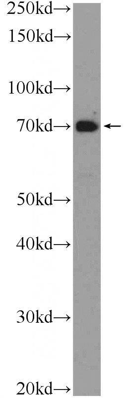 Jurkat cells were subjected to SDS PAGE followed by western blot with Catalog No:116870(WDR48 Antibody) at dilution of 1:600