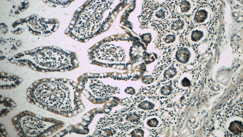 Immunohistochemistry of paraffin-embedded human small intestine tissue slide using Catalog No:108242(ARF1 Antibody) at dilution of 1:50 (under 10x lens)