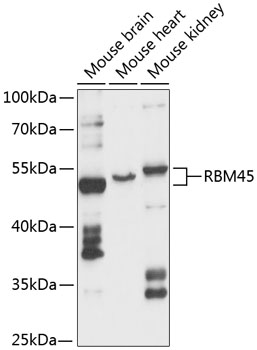 Western blot - RBM45 Polyclonal Antibody 