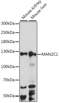 Western blot - MAN2C1 Polyclonal Antibody 