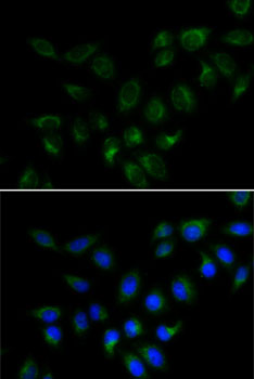 Immunofluorescence - BMP15 Polyclonal Antibody 
