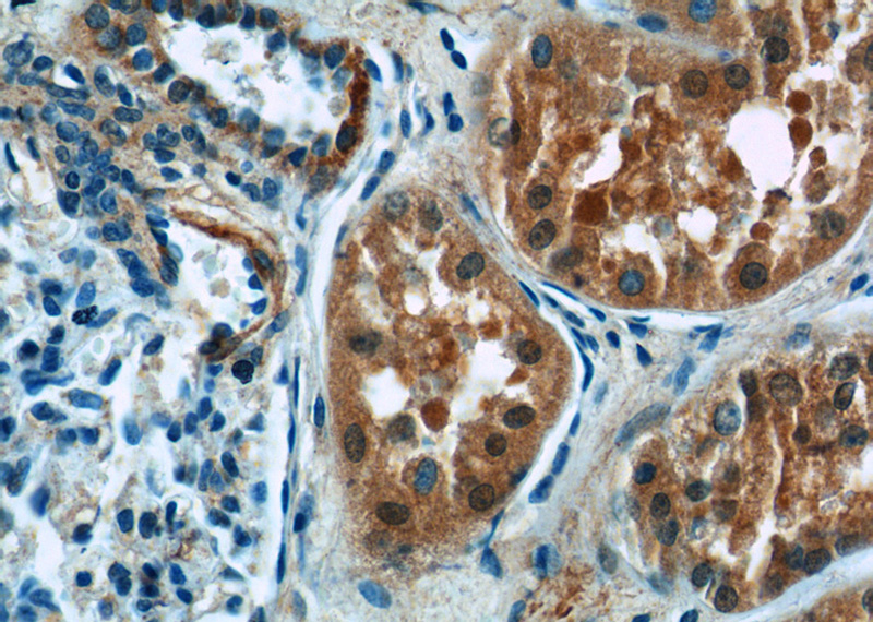 Immunohistochemistry of paraffin-embedded human kidney tissue slide using Catalog No:116454(TXNIP Antibody) at dilution of 1:50 (under 40x lens)