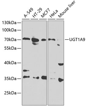 Western blot - UGT1A9 Polyclonal Antibody 