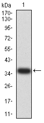 Fig1: Western blot analysis of PAK3 on human PAK3 recombinant protein using anti-PAK3 antibody at 1/1,000 dilution.