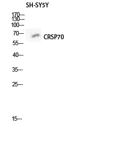 Fig1:; Western blot analysis of SH-SY5Y lysis using CRSP70 antibody. Antibody was diluted at 1:500 cells nucleus extracted by Minute TM Cytoplasmic and Nuclear Fractionation kit (SC-003,Inventbiotech,MN,USA).