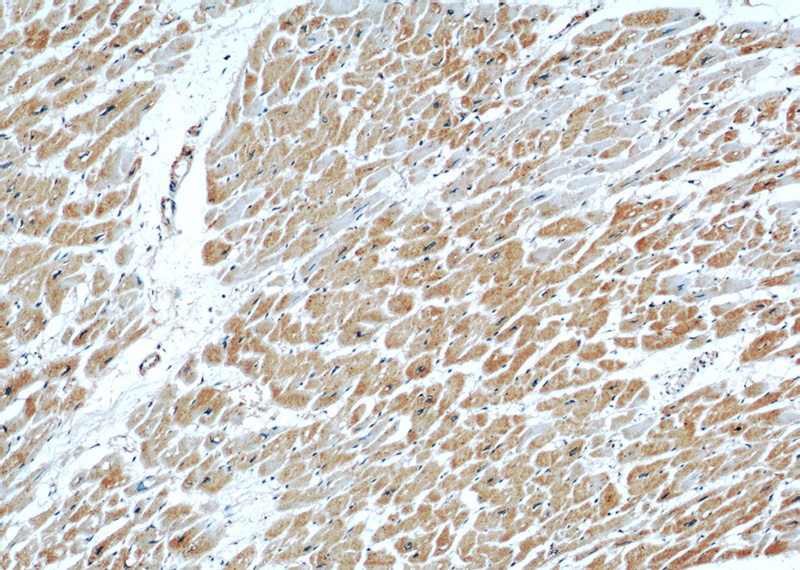 Immunohistochemical of paraffin-embedded human heart using Catalog No:114145(PPP1CC antibody) at dilution of 1:50 (under 10x lens)
