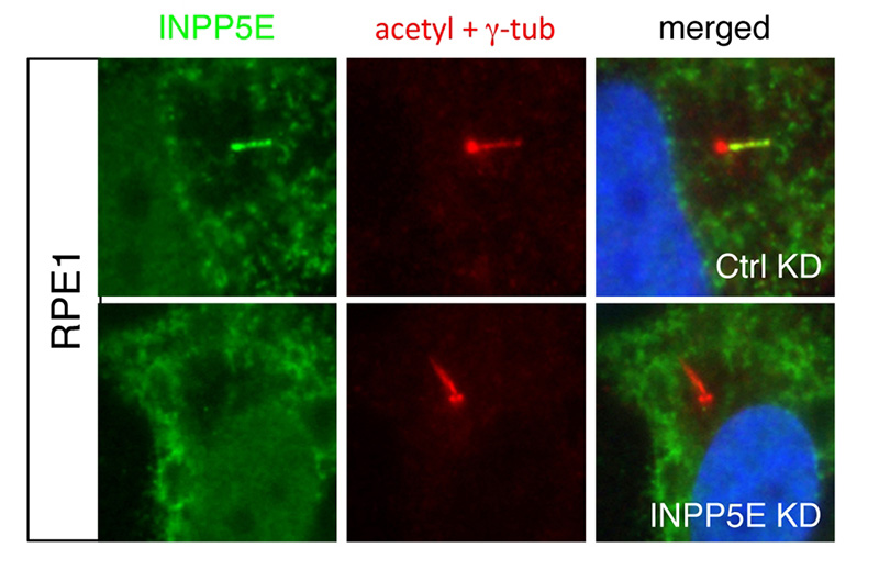 IF result of ciliary INPP5E in human hTERT-RPE1 cell: Upper is from control siRNA transfected cells and bottom is from INPP5E siRNA transfected cells. Catalog No:111844 specifically recognizes the ciliary INPP5E(From Dr.Seongjin Seo).