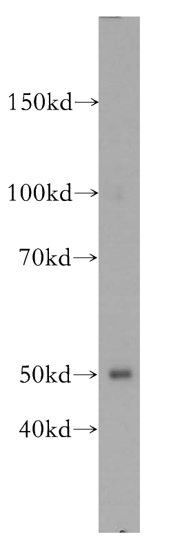 mouse cerebellum tissue were subjected to SDS PAGE followed by western blot with Catalog No:112636(MEF2C antibody) at dilution of 1:300