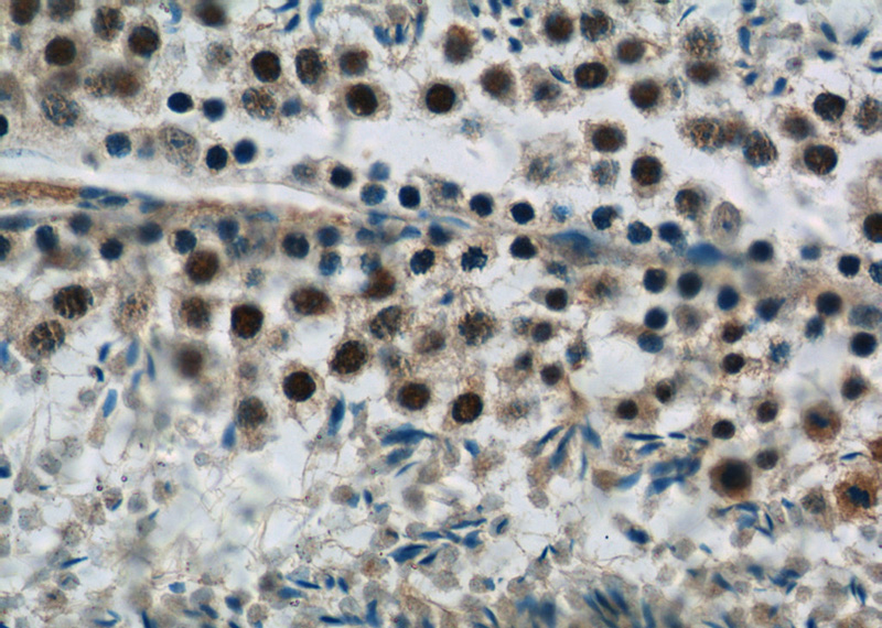 Immunohistochemistry of paraffin-embedded mouse testis tissue slide using Catalog No:115241(SIRT1 Antibody) at dilution of 1:50 (under 40x lens)