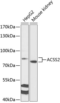 Western blot - ACSS2 Polyclonal Antibody 