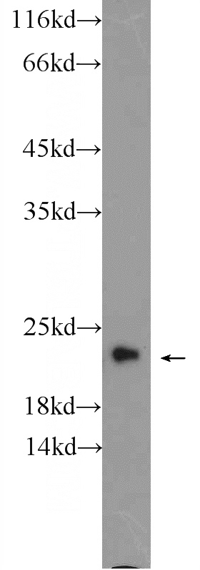 mouse brain tissue were subjected to SDS PAGE followed by western blot with Catalog No:108146(ARL8A Antibody) at dilution of 1:600