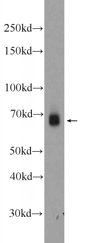 mouse skeletal muscle tissue were subjected to SDS PAGE followed by western blot with Catalog No:110423(EYA4 Antibody) at dilution of 1:1000