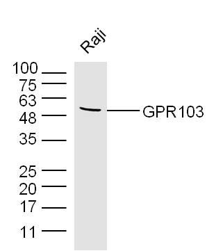 Fig1: Sample: Raji (human)Cell Lysate at 40 ug; Primary: Anti-GPR103 at 1/300 dilution; Secondary: IRDye800CW Goat Anti-Rabbit IgG at 1/20000 dilution; Predicted band size: 49 kD; Observed band size: 49 kD