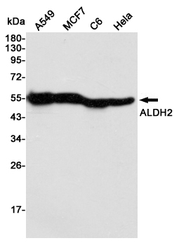 Western blot detection of ALDH2 in A549,MCF7,C6 and Hela cell lysates using ALDH2 mouse mAb (1:3000 diluted).Predicted band size:56KDa.Observed band size:56KDa.