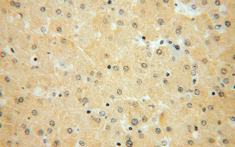 Immunohistochemical of paraffin-embedded human liver using Catalog No:111550(HSD17B7P2 antibody) at dilution of 1:50 (under 40x lens)
