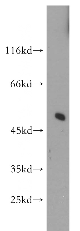 human brain tissue were subjected to SDS PAGE followed by western blot with Catalog No:115472(SNX17 antibody) at dilution of 1:300