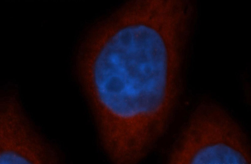 Immunofluorescent analysis of MCF-7 cells, using NQO1 antibody Catalog No:113227 at 1:50 dilution and Rhodamine-labeled goat anti-rabbit IgG (red). Blue pseudocolor = DAPI (fluorescent DNA dye).