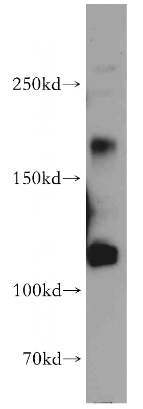 mouse kidney tissue were subjected to SDS PAGE followed by western blot with Catalog No:112454(MAGI1 antibody) at dilution of 1:500