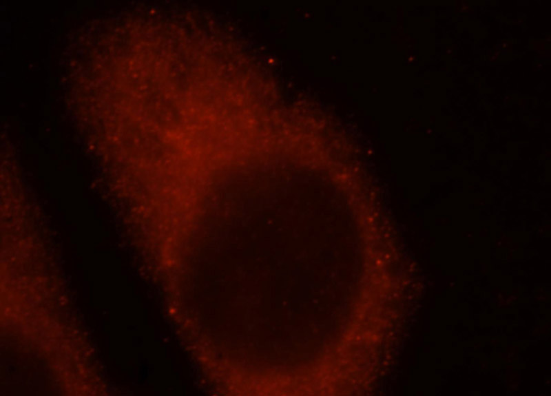 Immunofluorescent analysis of Hela cells, using IFFO1 antibody Catalog No:111614 at 1:25 dilution and Rhodamine-labeled goat anti-rabbit IgG (red).