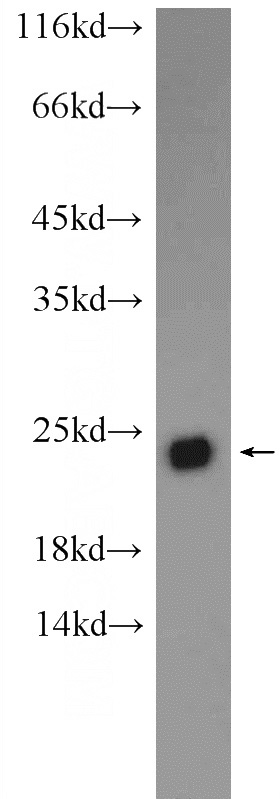 HEK-293 cells were subjected to SDS PAGE followed by western blot with Catalog No:108735(C5orf24 Antibody) at dilution of 1:1000