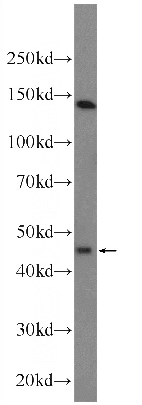 A431 cells were subjected to SDS PAGE followed by western blot with Catalog No:111972(KCNK18 Antibody) at dilution of 1:1000