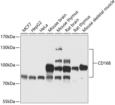 Western blot - CD168 Polyclonal Antibody 
