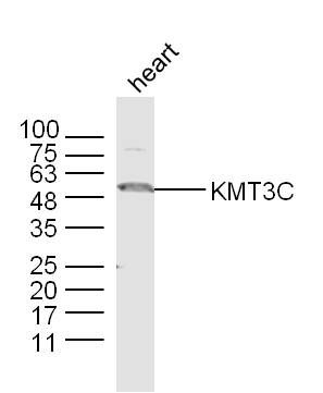 Fig2: Sample: heart (mouse) Lysate at 40 ug; Primary: Anti-KMT3C at 1/300 dilution; Secondary: IRDye800CW Goat Anti-Rabbit IgG at 1/20000 dilution; Predicted band size: 50 kD; Observed band size: 50 kD
