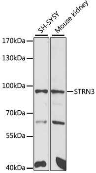 Western blot - STRN3 Polyclonal Antibody 