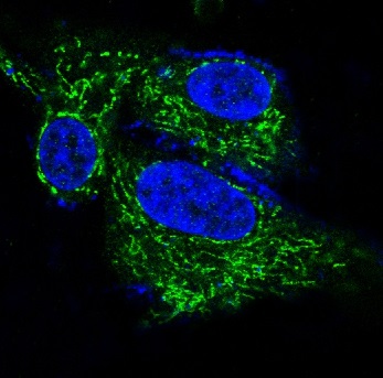 Immunofluorescent analysis of Hela cells, using BDNF Antibody.