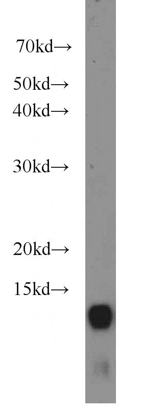 A549 cells were subjected to SDS PAGE followed by western blot with Catalog No:115602(SRX1 antibody) at dilution of 1:400