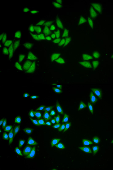 Immunofluorescence - UPF1 Polyclonal Antibody 