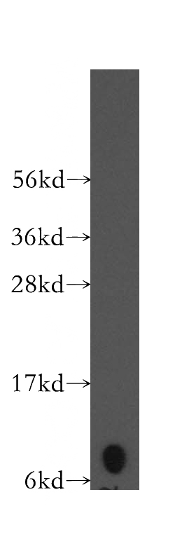 COLO 320 cells were subjected to SDS PAGE followed by western blot with Catalog No:111217(CXCL1 antibody) at dilution of 1:300