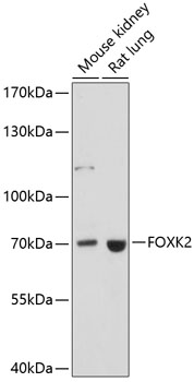 Western blot - FOXK2 Polyclonal Antibody 