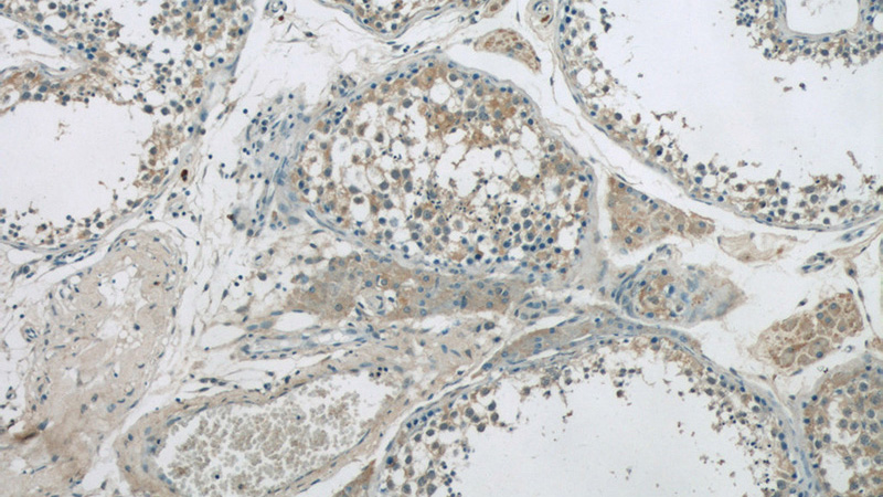 Immunohistochemistry of paraffin-embedded human testis tissue slide using Catalog No:115960(TEX15 Antibody) at dilution of 1:50 (under 10x lens)