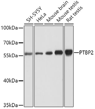 Western blot - PTBP2 Polyclonal Antibody 