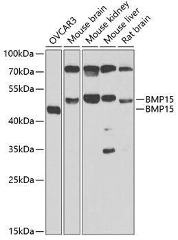 Western blot - BMP15 Polyclonal Antibody 
