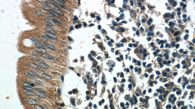 Immunohistochemistry of paraffin-embedded human colon tissue slide using Catalog No:111724(humanin Antibody) at dilution of 1:50 (under 40x lens)