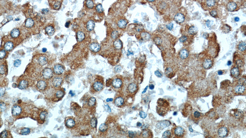 Immunohistochemical of paraffin-embedded human liver using Catalog No:114942(RWDD3 antibody) at dilution of 1:50 (under 40x lens)