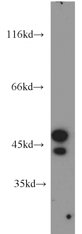 BxPC-3 cells were subjected to SDS PAGE followed by western blot with Catalog No:115712(STK17A antibody) at dilution of 1:2000
