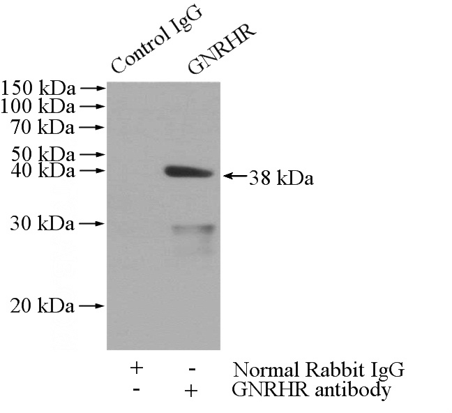 IP Result of anti-GNRHR (IP:Catalog No:111011, 4ug; Detection:Catalog No:111011 1:500) with MCF-7 cells lysate 1040ug.