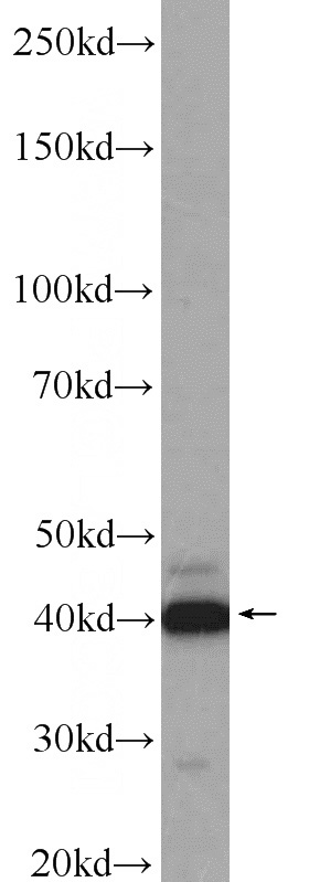 HEK-293 cells were subjected to SDS PAGE followed by western blot with Catalog No:108872(CASP12 antibody) at dilution of 1:1000