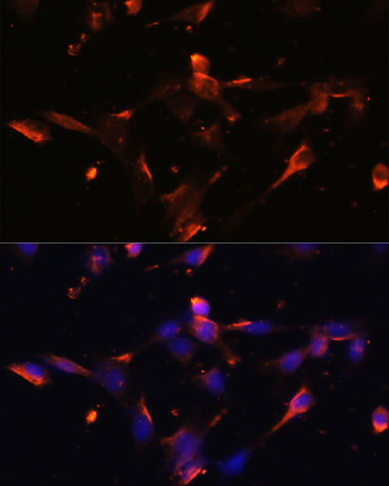Immunofluorescence - CLDN5 Polyclonal Antibody 