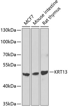 Western blot - KRT13 Polyclonal Antibody 