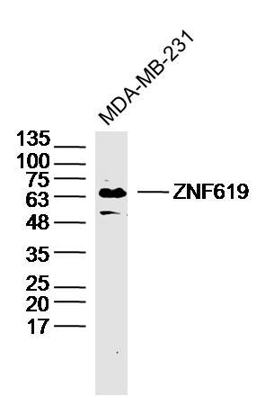 Fig2: Sample: MDA-MB-231 Cell (Human) Lysate at 40 ug; Primary: Anti- ZNF619 at 1/300 dilution; Secondary: IRDye800CW Goat Anti-Rabbit IgG at 1/20000 dilution; Predicted band size: 63 kD; Observed band size: 63 kD