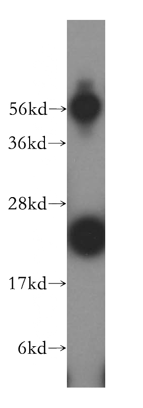 HeLa cells were subjected to SDS PAGE followed by western blot with Catalog No:112246(LITAF antibody) at dilution of 1:500